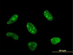 POLR1C Monoclonal Antibody (2A5-A5):Antibodies, Monoclonal