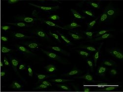 OXSR1 Monoclonal Antibody (2E9):Antibodies, Monoclonal