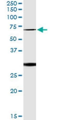 OXSR1 Monoclonal Antibody (2E9):Antibodies, Monoclonal