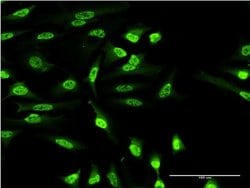 Invitrogen OXSR1 Monoclonal Antibody (1F6) 100 &mu;g; Unconjugated:Antibodies,