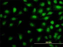 Invitrogen THRAP5 Monoclonal Antibody (3B10) 100 &mu;g; Unconjugated:Antibodies,