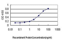 CTDSP2 Monoclonal Antibody (4F4):Antibodies, Monoclonal