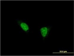 Invitrogen TSHZ1 Monoclonal Antibody (2F1) 100 &mu;g; Unconjugated:Antibodies,