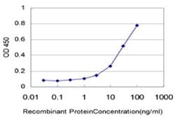 Invitrogen TOPORS Monoclonal Antibody (4G4) 100 &mu;g; Unconjugated:Antibodies,