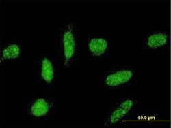 Invitrogen TOPORS Monoclonal Antibody (4G4) 100 &mu;g; Unconjugated:Antibodies,