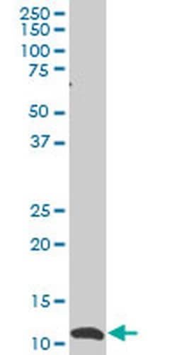 Invitrogen SNAPC5 Monoclonal Antibody (5C3) 100 &mu;g; Unconjugated:Antibodies,