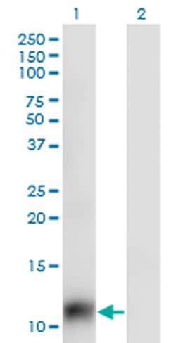 Invitrogen SNAPC5 Monoclonal Antibody (5C3) 100 &mu;g; Unconjugated:Antibodies,