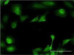 B3GNT3 Monoclonal Antibody (1A2), Invitrogen 100 &mu;g; Unconjugated:Antibodies,