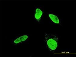 TESK2 Monoclonal Antibody (5H4):Antibodies, Monoclonal