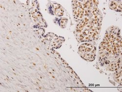 TESK2 Monoclonal Antibody (5H4):Antibodies, Monoclonal