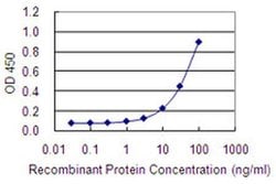 Invitrogen LRRN2 Monoclonal Antibody (6A9) 100 &mu;g; Unconjugated:Antibodies,