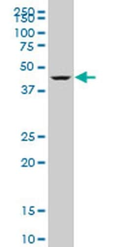 Invitrogen DEAF1 Monoclonal Antibody (3E6) 100 &mu;g; Unconjugated:Antibodies,