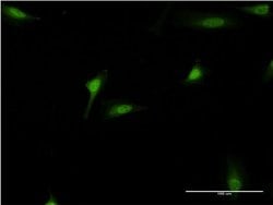 Invitrogen DEAF1 Monoclonal Antibody (2A2) 100 &mu;g; Unconjugated:Antibodies,
