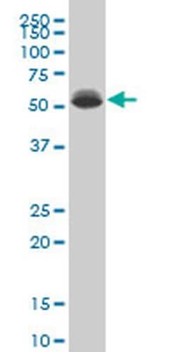 Invitrogen DEAF1 Monoclonal Antibody (2A2) 100 &mu;g; Unconjugated:Antibodies,