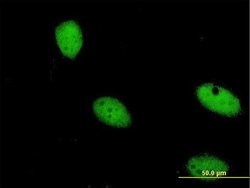 Invitrogen ZNF274 Monoclonal Antibody (1D8) 100 &mu;g; Unconjugated:Antibodies,