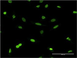Invitrogen HP1 beta Monoclonal Antibody (4E12) 100 &mu;g; Unconjugated:Antibodies,