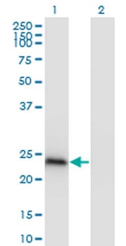 Invitrogen HP1 beta Monoclonal Antibody (4E12) 100 &mu;g; Unconjugated:Antibodies,