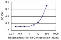 ADAM30 Monoclonal Antibody (3E5):Antibodies, Monoclonal