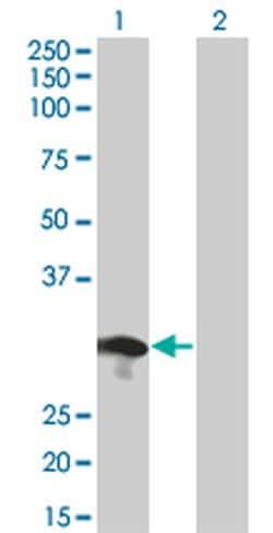 RABL2B Monoclonal Antibody (1B10):Antibodies, Monoclonal