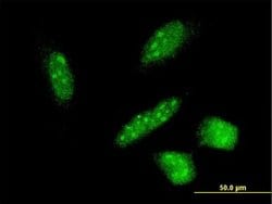 Invitrogen RNF24 Monoclonal Antibody (4C6) 100 &mu;g; Unconjugated:Antibodies,