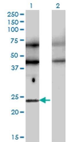 TFEC Monoclonal Antibody (4F11):Antibodies, Monoclonal