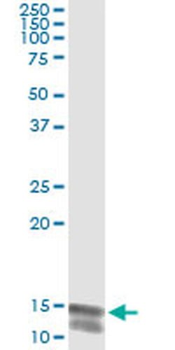 NLGN4Y Monoclonal Antibody (2F7):Antibodies, Monoclonal