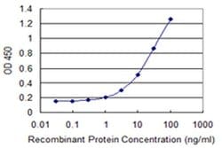 Invitrogen EXOSC7 Monoclonal Antibody (2F10) 100 &mu;g; Unconjugated:Antibodies,