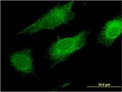 Invitrogen LFG Monoclonal Antibody (2C2) 100 &mu;g; Unconjugated:Antibodies,