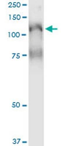 PLCL2 Monoclonal Antibody (1C7):Antibodies, Monoclonal