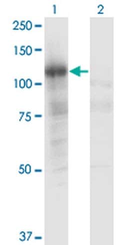 PLCL2 Monoclonal Antibody (1C7):Antibodies, Monoclonal