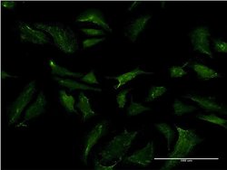 Invitrogen ABCB9 Monoclonal Antibody (4F4) 100 &mu;g; Unconjugated:Antibodies,