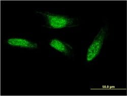 Invitrogen SEC14L2 Monoclonal Antibody (2E5) 100 &mu;g; Unconjugated:Antibodies,