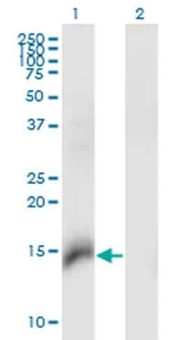 Invitrogen CBY1 Monoclonal Antibody (2F2) 100 &mu;g; Unconjugated:Antibodies,
