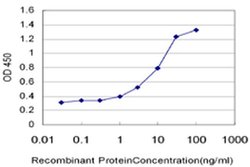 Invitrogen TRPC4AP Monoclonal Antibody (3G4) 100 &mu;g; Unconjugated:Antibodies,