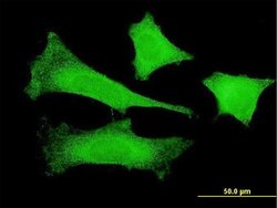 FBXO4 Monoclonal Antibody (2F2):Antibodies, Monoclonal