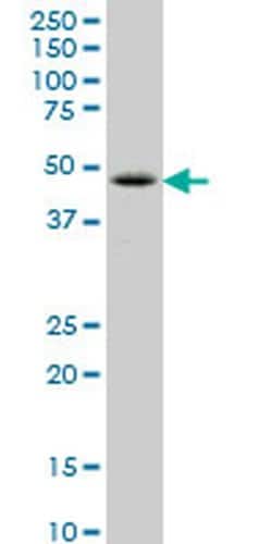 LHX6 Monoclonal Antibody (2A2):Antibodies, Monoclonal