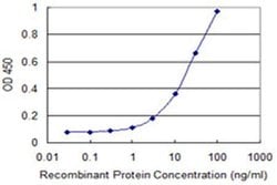 Invitrogen KCNMB3 Monoclonal Antibody (3E5) 100 &mu;g; Unconjugated:Antibodies,
