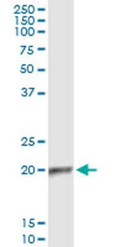 Invitrogen APOBEC3C Monoclonal Antibody (3E6) 100 &mu;g; Unconjugated:Antibodies,