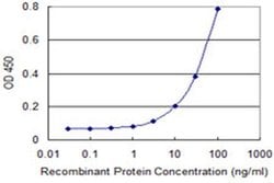 SLC6A16 Monoclonal Antibody (2E5):Antibodies, Monoclonal