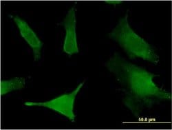 SLC6A16 Monoclonal Antibody (2E5):Antibodies, Monoclonal