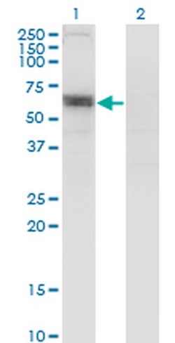 SLC6A16 Monoclonal Antibody (2E5):Antibodies, Monoclonal