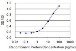 Invitrogen TSP50 Monoclonal Antibody (2D8) 100 &mu;g; Unconjugated:Antibodies,