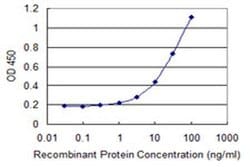 Invitrogen UCRC Monoclonal Antibody (2B5) 100 &mu;g; Unconjugated:Antibodies,