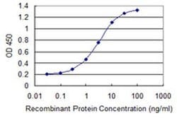 Invitrogen TRIM17 Monoclonal Antibody (2E11) 100 &mu;g; Unconjugated:Antibodies,