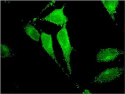 Invitrogen TRIM17 Monoclonal Antibody (2E11) 100 &mu;g; Unconjugated:Antibodies,