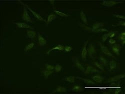 Invitrogen ASB3 Monoclonal Antibody (3E5) 100 &mu;g; Unconjugated:Antibodies,