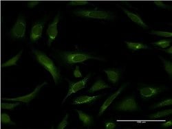 Invitrogen PIPOX Monoclonal Antibody (3D1) 100 &mu;g | Buy Online | Invitrogen&trade; | Fisher Scientific
