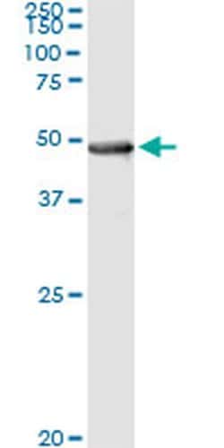 Invitrogen PIPOX Monoclonal Antibody (3D1) 100 &mu;g | Buy Online | Invitrogen&trade; | Fisher Scientific