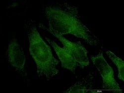 Invitrogen TRAPPC4 Monoclonal Antibody (2D5) 100 &mu;g; Unconjugated:Antibodies,