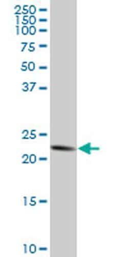 Invitrogen TRAPPC4 Monoclonal Antibody (2D5) 100 &mu;g; Unconjugated:Antibodies,